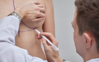 Augmentation mammaire par prothèses ou par lipofilling ?  Comparaison entre 2 techniques pharess