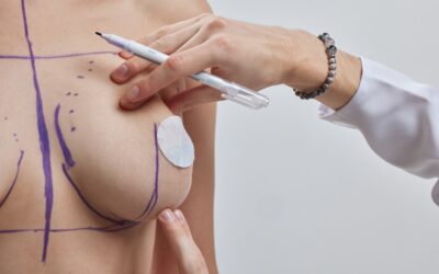 Augmentation mammaire : un booster de confiance en soi à travers les étapes de la vie