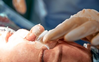 Mon expérience avant-après d’une rhinoplastie : un changement subtil mais marquant