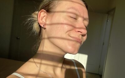 La mésothérapie revitalise la peau en profondeur, sans éviction sociale